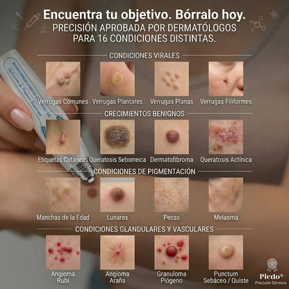 𝐏𝐢𝐜𝐝𝐨®🖤🍰Borrador de Verrugas y Manchas en 7 Días (𝐀𝐩𝐥𝐢𝐜𝐚𝐝𝐨𝐫 𝐫𝐨𝐥𝐥-𝐨𝐧: 𝐬𝐢𝐧 𝐝𝐨𝐥𝐨𝐫 𝐧𝐢 𝐜𝐢𝐜𝐚𝐭𝐫𝐢𝐜𝐞𝐬)