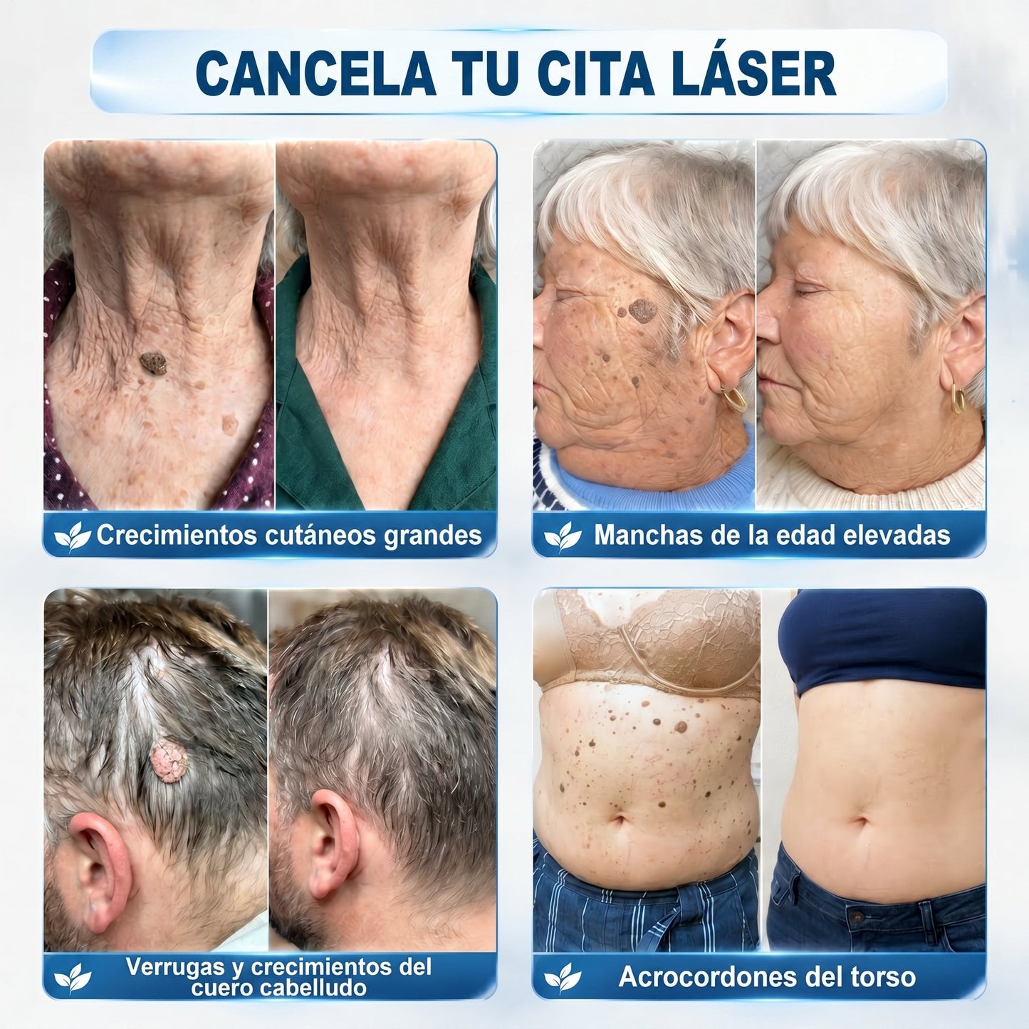 𝐏𝐢𝐜𝐝𝐨®🖤🍰Borrador de Verrugas y Manchas en 7 Días (𝐀𝐩𝐥𝐢𝐜𝐚𝐝𝐨𝐫 𝐫𝐨𝐥𝐥-𝐨𝐧: 𝐬𝐢𝐧 𝐝𝐨𝐥𝐨𝐫 𝐧𝐢 𝐜𝐢𝐜𝐚𝐭𝐫𝐢𝐜𝐞𝐬)